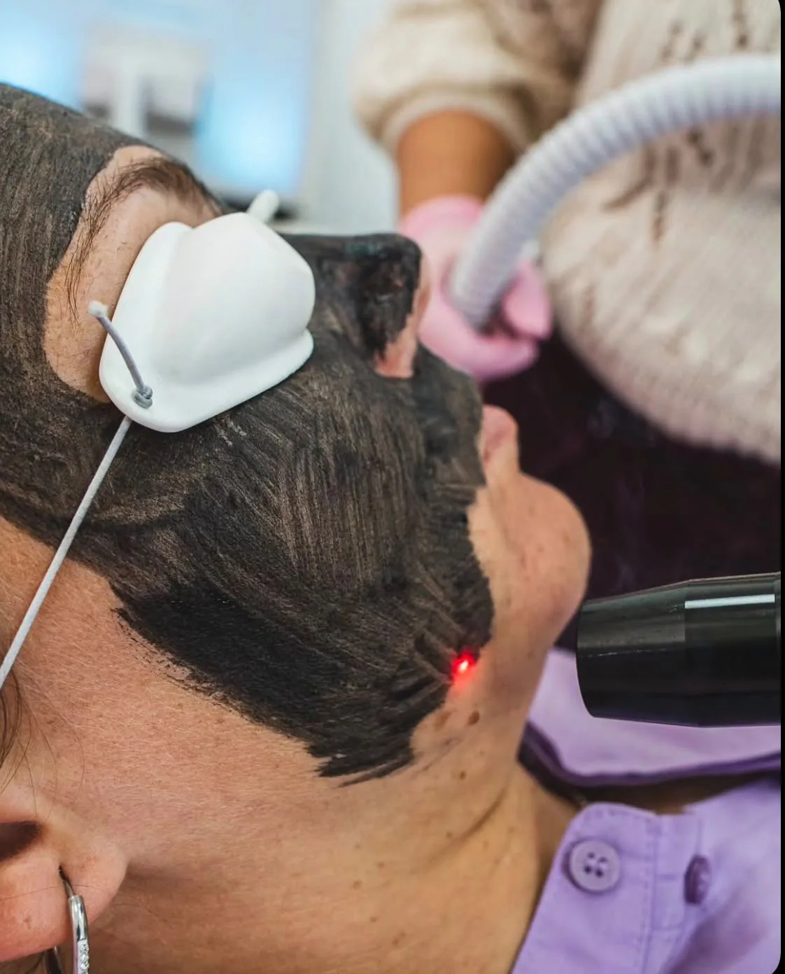 Tratamiento facial con láser de diodo y manopla de frío
